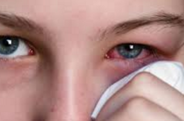 olho com conjuntivite